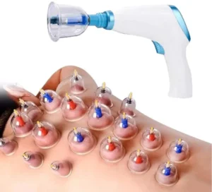 Hijama Therapy: The Ultimate Detox for Mind, Body, and Spirit